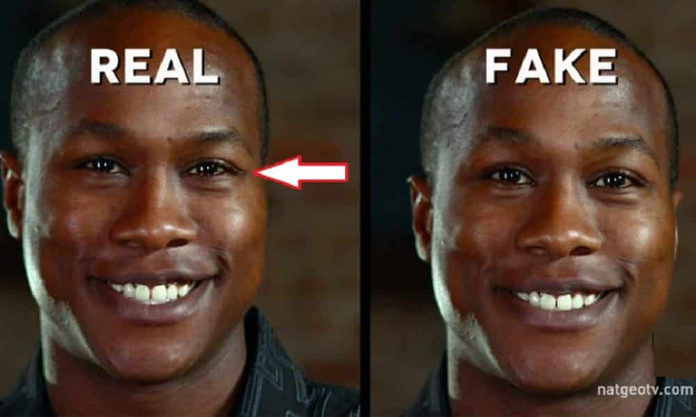 qual o seu tipo de sorriso