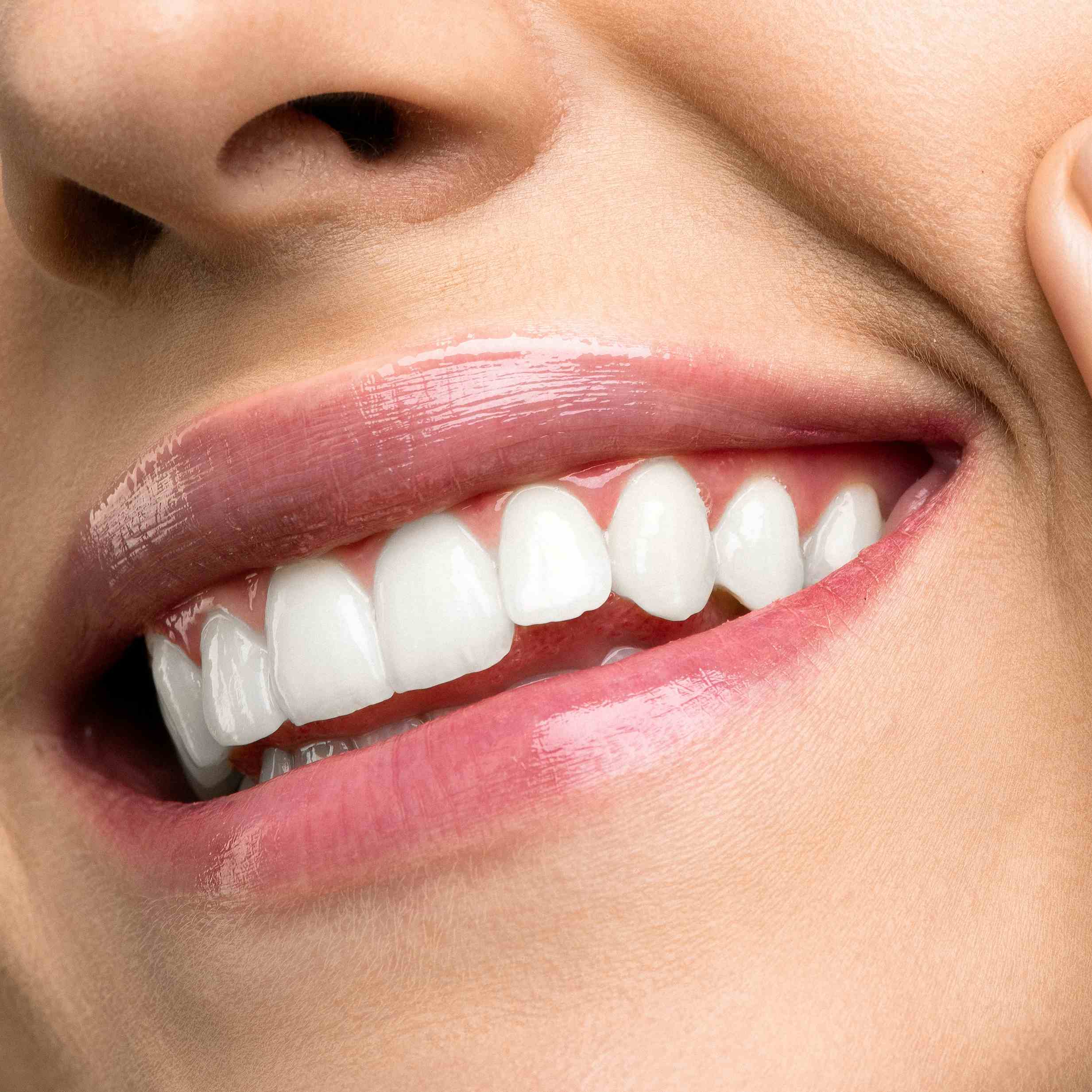 quantos tipos de sorriso existem