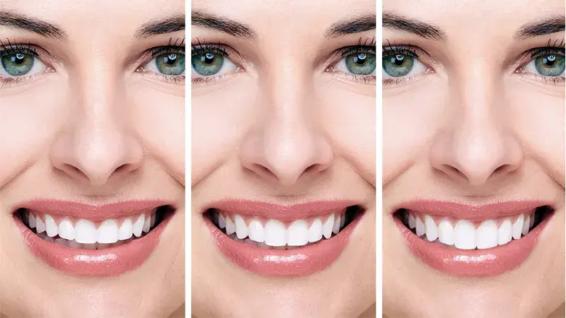 o que significa um sorriso invertido