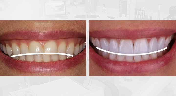 sorriso sedutor como fazer