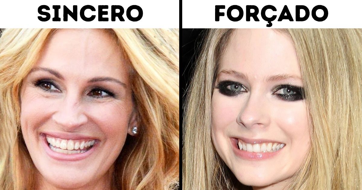 diferença sorriso duchenne e falso